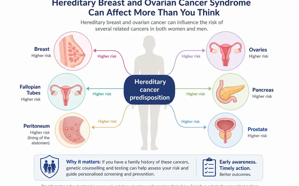 Diagram showing hereditary breast and ovarian cancer syndrome linked to several organs, including breast, ovaries, fallopian tubes, pancreas and prostate.